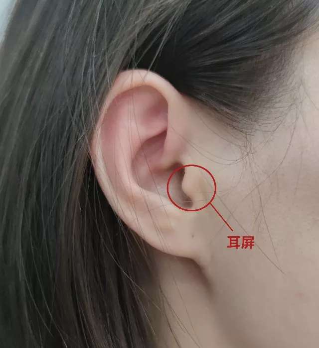 图为“耳屏”